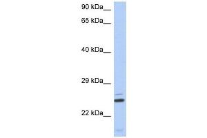 TTC9C antibody used at 1 ug/ml to detect target protein. (TTC9C Antikörper  (N-Term))