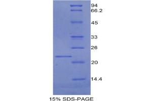 SDS-PAGE analysis of Rat PROCR Protein. (PROCR Protein)
