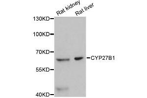 Western blot analysis of extracts of various cell lines, using CYP27B1 antibody (ABIN4903424) at 1:3000 dilution.
