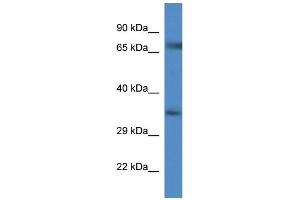 WB Suggested Anti-Slc6a9 AntibodyTitration: 1. (GLYT1 Antikörper  (C-Term))