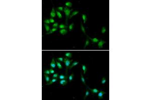 Immunofluorescence analysis of A549 cells using HEXIM1 antibody (ABIN5973397). (HEXIM1 Antikörper)