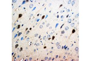 Anti-Neurotrophin 3 antibody, IHC(P) IHC(P): Rat Brain Tissue