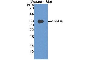 Western Blotting (WB) image for anti-DNA Fragmentation Factor, 45kDa, alpha Polypeptide (DFFA) (AA 51-305) antibody (ABIN3202366)