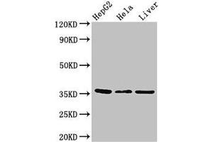Western Blot Positive WB detected in: HepG2 whole cell lysate, Hela whole cell lysate, Mouse liver tissue All lanes: SPRY1 antibody at 2. (SPRY1 Antikörper  (AA 1-178))