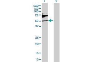 Western Blot analysis of SH2B1 expression in transfected 293T cell line by SH2B1 MaxPab polyclonal antibody. (SH2B1 Antikörper  (AA 1-426))