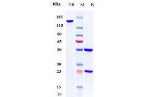 Anti-EpCAM / TROP1 / CD326 Reference Antibody (citatuzumab) on SDS-PAGE under reducing (R) condition.