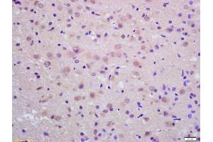 Formalin-fixed and paraffin embedded rat brain labeled with Anti-Neprilysin 2 Polyclonal Antibody, Unconjugated (ABIN1386041) at 1:200 followed by conjugation to the secondary antibody and DAB staining (MMEL1 Antikörper  (AA 451-550))