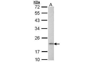 WB Image Sample (30 ug of whole cell lysate) A: Raji 12% SDS PAGE antibody diluted at 1:1000 (AP1S2 Antikörper  (full length))