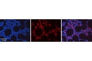 Rabbit Anti-REL Antibody Catalog Number: ARP36966_P050 Formalin Fixed Paraffin Embedded Tissue: Human Bone Marrow Tissue Observed Staining: Nucleus, Cytoplasm Primary Antibody Concentration: 1:100 Other Working Concentrations: 1:600 Secondary Antibody: Donkey anti-Rabbit-Cy3 Secondary Antibody Concentration: 1:200 Magnification: 20X Exposure Time: 0. (c-Rel Antikörper  (Middle Region))