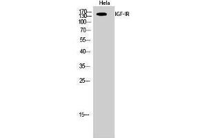 Western Blotting (WB) image for anti-Insulin-Like Growth Factor 1 Receptor (IGF1R) (Ser1026) antibody (ABIN3185133)
