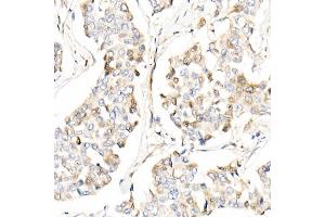 Immunohistochemistry (IHC) image for anti-Apoptosis-Inducing Factor, Mitochondrion-Associated, 2 (AIFM2) (AA 1-373) antibody (ABIN6136678)