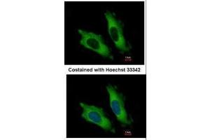 ICC/IF Image Immunofluorescence analysis of methanol-fixed HeLa, using EIF4A2, antibody at 1:500 dilution. (EIF4A2 Antikörper)