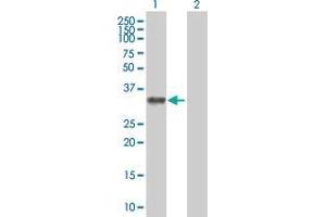 Western Blotting (WB) image for MYOZ2 293T Cell Transient Overexpression Lysate(Denatured) (ABIN1336516)