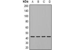 Western blot analysis of TIA1 expression in SKOV3 (A), Hela (B), mouse brain (C), rat brain (D) whole cell lysates.