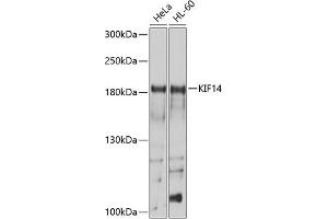 Western blot analysis of extracts of various cell lines, using KIF14 antibody (ABIN6129691, ABIN6142854, ABIN6142855 and ABIN6214465) at 1:1000 dilution. (KIF14 Antikörper  (AA 1399-1648))