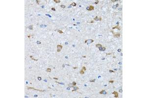 Immunohistochemistry of paraffin-embedded mouse spinal cord using RARS antibody (ABIN5973728) at dilution of 1/100 (40x lens). (RARS Antikörper)
