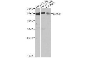 Western blot analysis of extracts of various cell lines, using CD200 antibody (ABIN2561685) at 1:1000 dilution. (CD200 Antikörper)