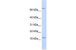 TRA16 antibody used at 1 ug/ml to detect target protein. (NR2C2AP Antikörper  (N-Term))
