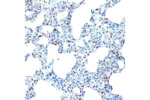 Immunohistochemistry of paraffin-embedded rat lung using CXCL4/CXCL4/PF4 Rabbit mAb (ABIN1683188, ABIN3017983, ABIN3017984 and ABIN7101555) at dilution of 1:100 (40x lens). (PF4 Antikörper)