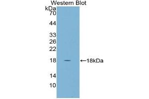 Western blot analysis of the recombinant protein. (CST5 Antikörper  (AA 21-142))