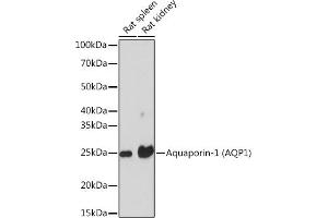 Western blot analysis of extracts of various cell lines, using Aquaporin-1 (Aquaporin-1 ) Rabbit mAb (ABIN1682901, ABIN3018679, ABIN3018680 and ABIN7101646) at 1:1000 dilution. (Aquaporin 1 Antikörper)