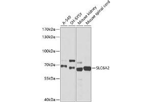 SLC6A2 Antikörper  (AA 1-70)