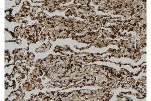 ABIN6261376 and ABIN6277015 at 1/100 staining Human lung tissue by IHC-P.