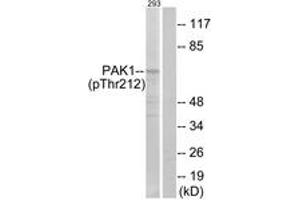 Western blot analysis of extracts from 293 cells treated with etoposide 25uM 1h, using PAK1 (Phospho-Thr212) Antibody. (PAK1 Antikörper  (pThr212))
