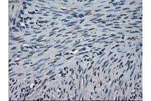Image no. 1 for anti-Crystallin, alpha B (CRYAB) antibody (ABIN1497641) (CRYAB Antikörper)