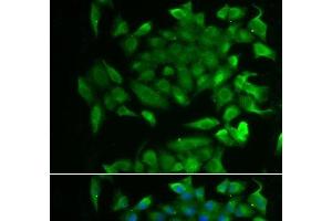 Immunofluorescence analysis of MCF-7 cells using RBP2 Polyclonal Antibody (RBP2 Antikörper)