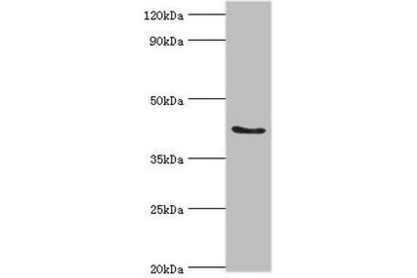 ADAP1 Antikörper  (AA 1-374)