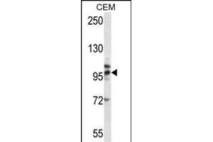 TLR2 Antibody (Center) (ABIN657617 and ABIN2846613) western blot analysis in CEM cell line lysates (35 μg/lane).