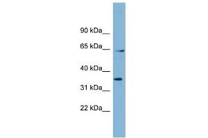 WB Suggested Anti-RANGAP1 Antibody Titration: 0. (RANGAP1 Antikörper  (N-Term))