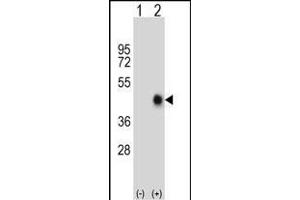 Western blot analysis of FAS (arrow) using rabbit polyclonal FAS Antibody (Center) (ABIN652469 and ABIN2842320). (FAS Antikörper  (AA 185-211))