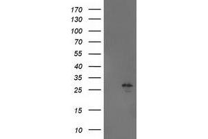 Western Blotting (WB) image for anti-Adenylate Kinase 4 (AK4) antibody (ABIN1496524) (AK4 Antikörper)