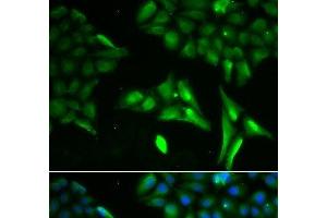 Immunofluorescence analysis of U2OS cells using ACADS Polyclonal Antibody (ACADS Antikörper)