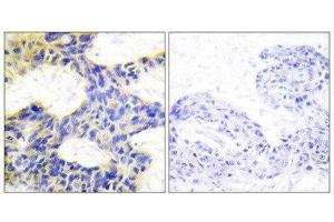 Immunohistochemistry (IHC) image for anti-Ribosomal Protein S6 Kinase, 70kDa, Polypeptide 1 (RPS6KB1) (Internal Region) antibody (ABIN1849255) (RPS6KB1 Antikörper  (Internal Region))