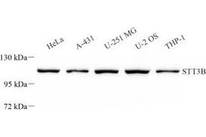 Western blot analysis of STT3B (ABIN7075745) at dilution of 1: 2000 (STT3B Antikörper)