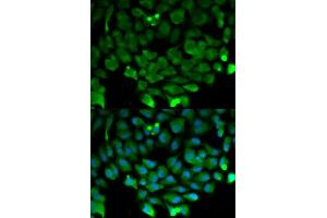 Immunofluorescence analysis of HeLa cell using CUL3 antibody. (Cullin 3 Antikörper  (AA 569-768))