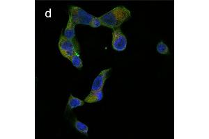 Detection of cathepsin B (CB) activity in Eca-109 cells by the CB probe. (Ziege anti-Kaninchen IgG Antikörper (FITC))
