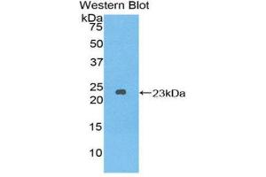 Western Blotting (WB) image for anti-Dishevelled, Dsh Homolog 2 (Drosophila) (DVL2) (AA 78-250) antibody (ABIN1858675) (DVL2 Antikörper  (AA 78-250))