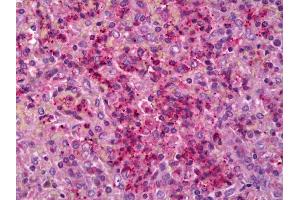 Anti-IL6R antibody IHC of human spleen. (IL-6 Receptor Antikörper)