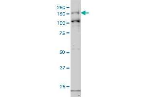 GAK monoclonal antibody (M01), clone 4C10 Western Blot analysis of GAK expression in Hela S3 NE . (GAK Antikörper  (AA 151-250))
