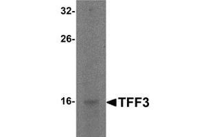 Western blot analysis of TFF3 in rat small intestine tissue lysate with TFF3 antibody at 2 μg/ml. (TFF3 Antikörper  (C-Term))