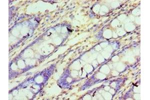 Immunohistochemistry of paraffin-embedded human colon tissue using ABIN7148780 at dilution of 1:100 (CXXC1 Antikörper  (AA 1-210))