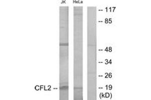 Western blot analysis of extracts from Jurkat/HeLa cells, using Cofilin Antibody. (Cofilin Antikörper  (AA 61-110))