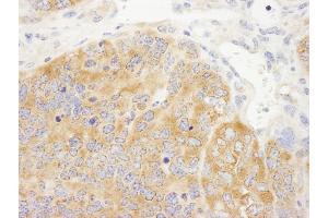 Immunohistochemistry (IHC) image for anti-DEAD (Asp-Glu-Ala-Asp) Box Polypeptide 6 (DDX6) (AA 1-50) antibody (ABIN7448524)