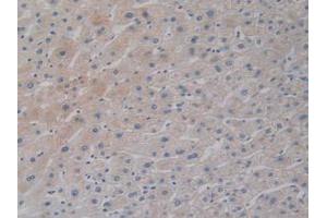 IHC-P analysis of Human Liver Tissue, with DAB staining. (DCLK1 Antikörper  (AA 390-647))