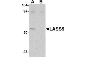 Western Blotting (WB) image for anti-LAG1 Homolog, Ceramide Synthase 5 (LASS5) (C-Term) antibody (ABIN1030478)