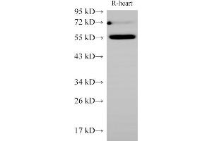 Western Blot analysis of Rat Heart using Ceacam1 Polycloanl Antibody at dilution of 1:1000 (CEACAM1 Antikörper)